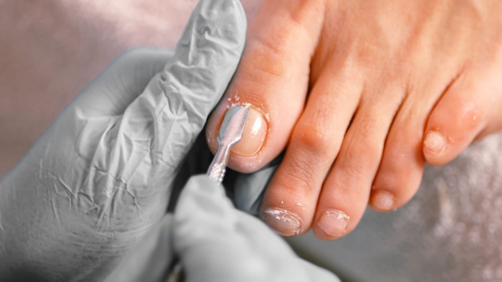 Pedicure behandelt teennagels van klant met instrument
